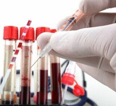 Учеными найдено лекарство от ВИЧ