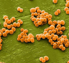 Новый антибиотик способен убивать лекарственно-устойчивые бактерии