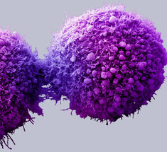 Невезение — более вероятная причина рака, нежели образ жизни или гены