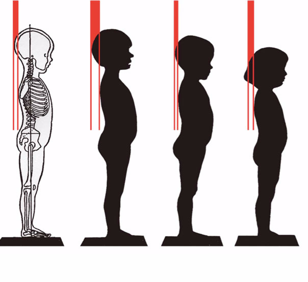 Стена осанка. Кифоз позвоночника у детей 5 лет. Тестирование осанки. Нарушение осанки. Тест на правильность осанки.