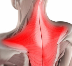 Растяжение трапециевидных  мыщц при боли в верхней части спины