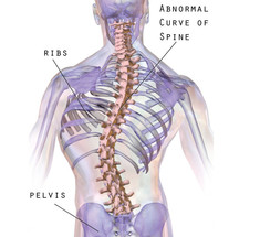 Висцеральные сколиозы: соответствие деформации позвоночника дисфункции конкретного органа