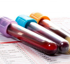 Анализ крови: 9 показателей общего анализа
