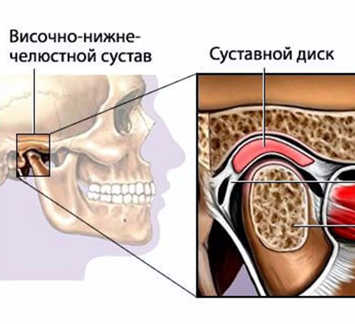 Суставной диск. Межсуставной диск ВНЧС. Суставной бугорок ВНЧС. Височный Нижний челюстной сустав. Синовиальная жидкость ВНЧС.