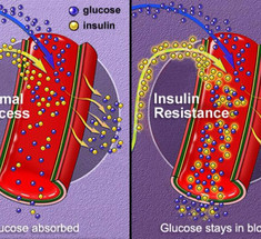 Когда инсулинорезистентность бывает полезна: от иммунитета до крепкого сна
