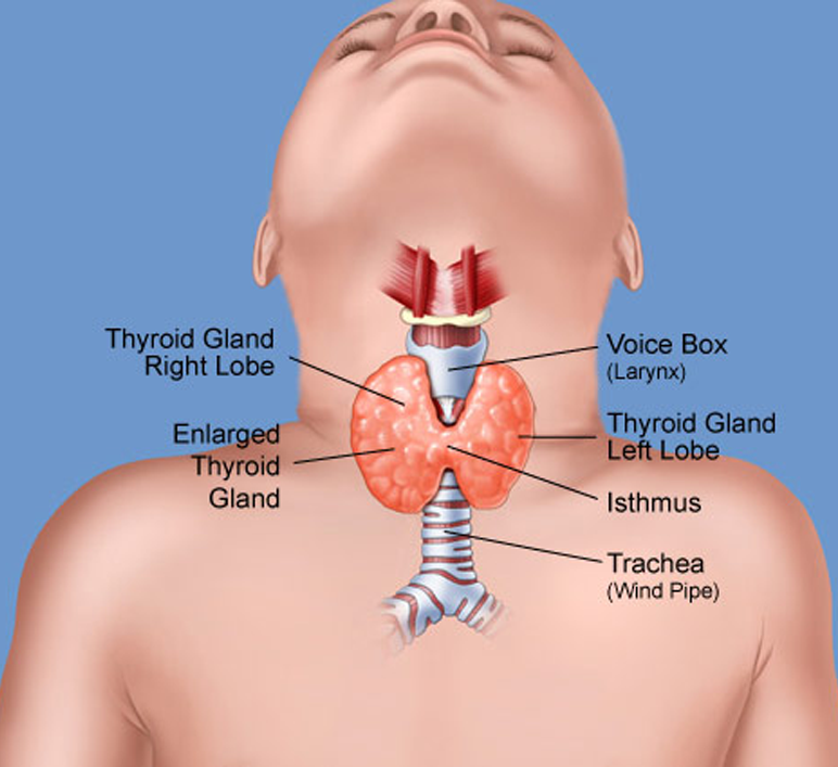 Болезни щитовидки у детей. Щитовидная железа у детей 8 лет.