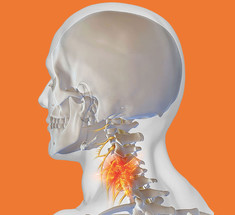 Остеохондроз: Что делать, если болят шея и голова 