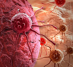 12 лучших стратегий профилактики рака: советы врача