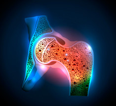Как предотвратить остеопороз: ключ к крепким костям