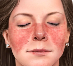 7 сигналов вашей кожи, предупреждающие о серьезных заболеваниях