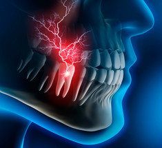 Компрессы от зубной боли из гвоздики 
