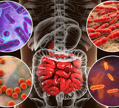 Дисбактериоз: факторы, опасность и как диагностировать проблему