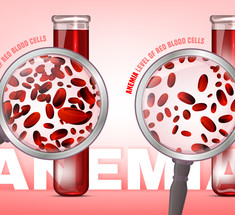 Как повысить низкий гемоглобин при железодефицитной анемии?