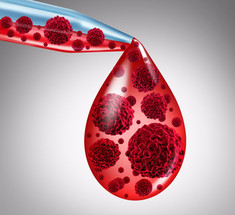 Густая кровь: Как восстановить качество крови