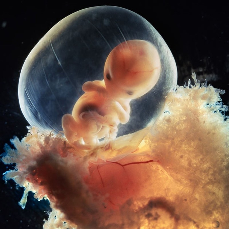 Уникальные кадры: от зачатия до рождения
