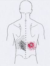 Триггеры: Карта точек боли и напряжения в теле 
