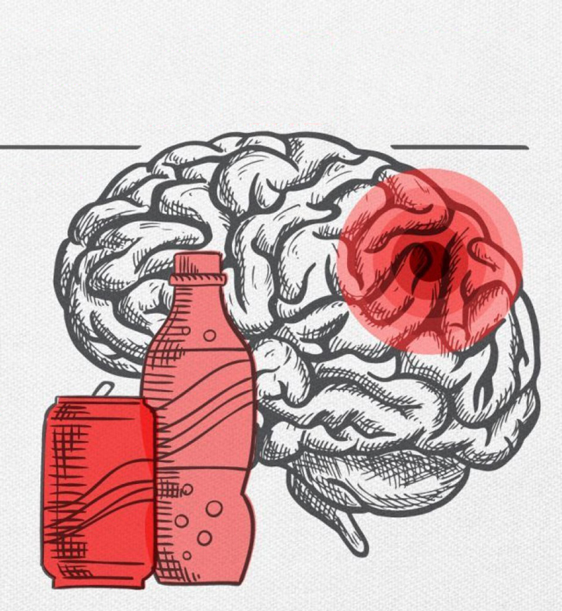 Связь между «диетическими» напитками, инсультом и болезнью Альцгеймера