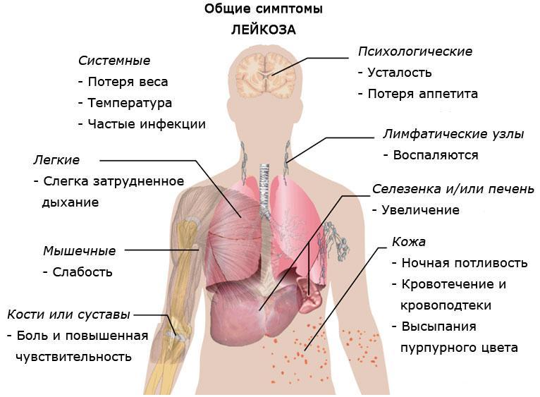 Майкл Грегер: Как не умереть от рака крови