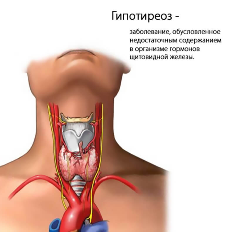 Тупик эндокринологии: Причины заболевания щитовидной железы