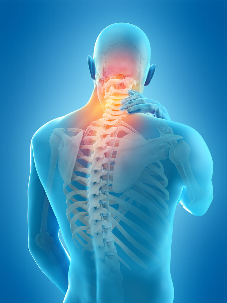 Упражнения, которые уменьшат хроническую боль в шее и плечах