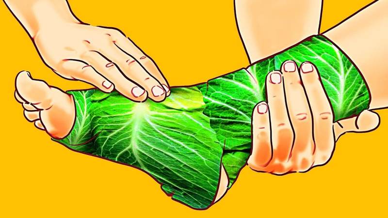 Подагра и отечность ног: лечение капустным листьями