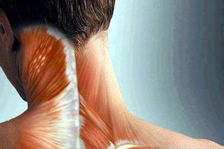 Цервикогенная головная боль: причины и симптомы