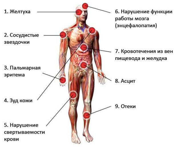 Признаки нарушения работы ПЕЧЕНИ