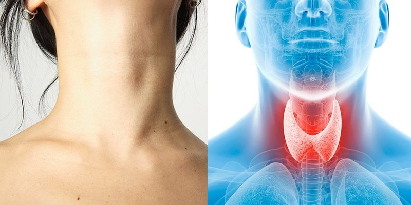 Овощи, которые могут повлиять на работу щитовидной железы