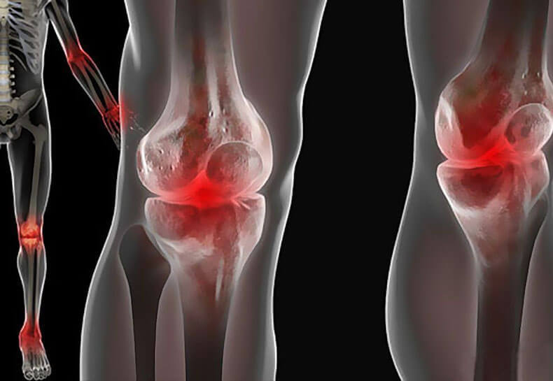 Коленные круги: Упражнение, которое поможет проработать тазобедренные и коленные суставы
