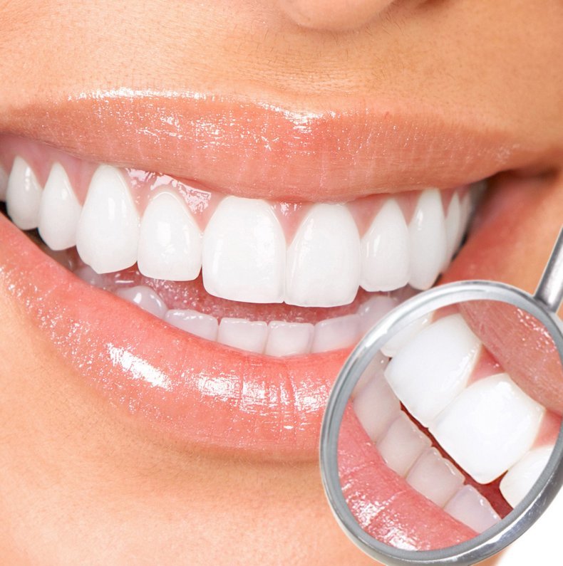 Лучшие способы отбеливания зубов в домашних условиях
