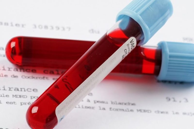 Анализ крови: 18 тестов, которые расскажут о истинном состоянии здоровья
