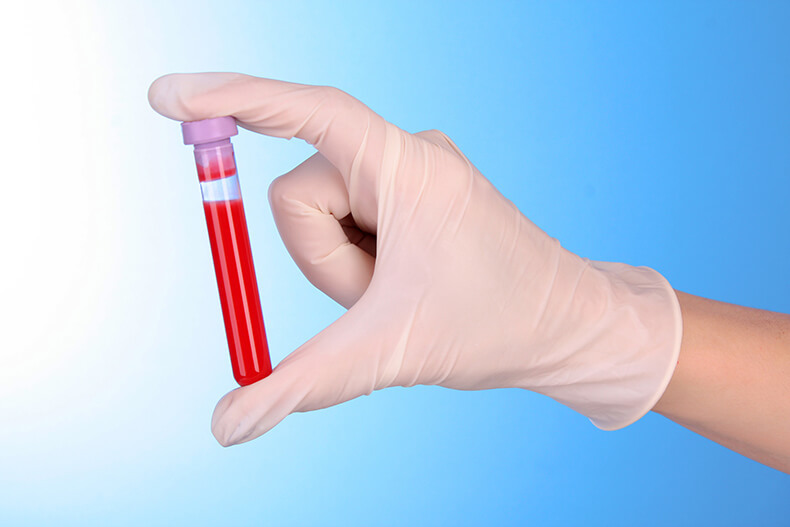О каких патологиях может рассказать биохимический анализ крови