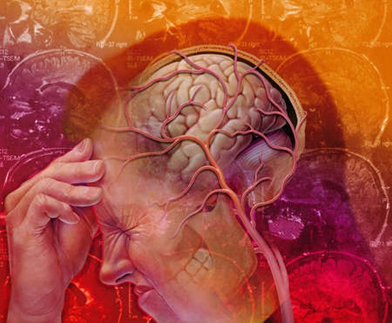 Психосоматика головных болей: Что болит на самом деле