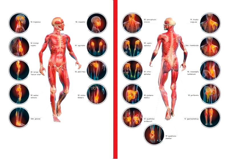 Триггерные точки на теле человека фото с описанием для снятия боли в бедре