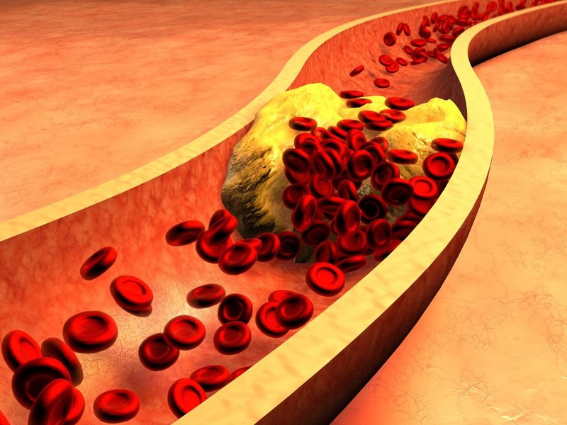 Важные факты о холестерине, о которых мало кто знает