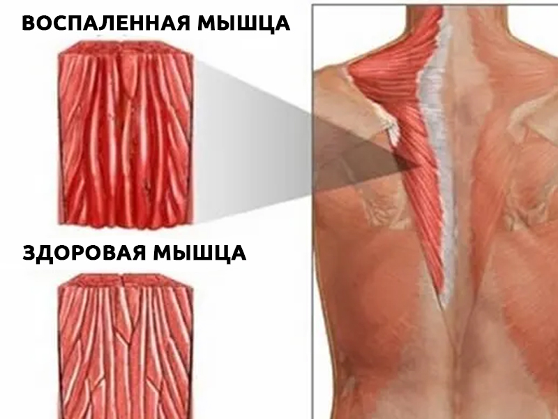 12 продуктов, которые спасут от боли в мышцах после тренировки