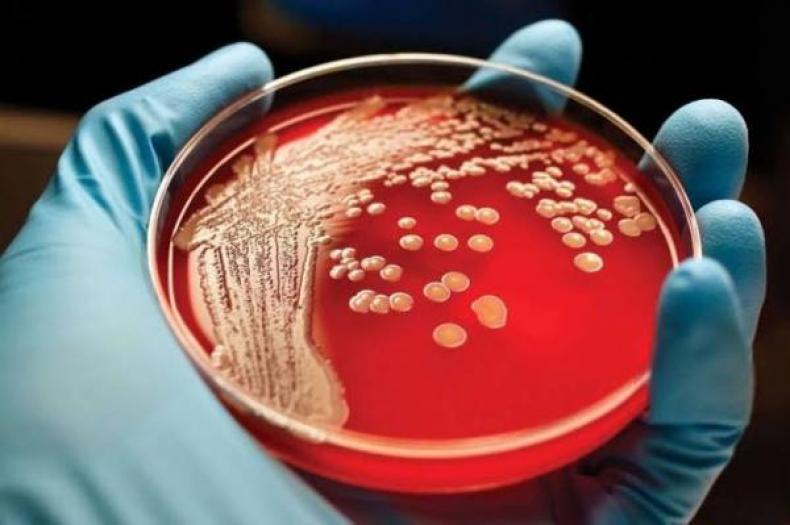Как обеззаразить дом: чего боится стафилококк и другие бактерии?