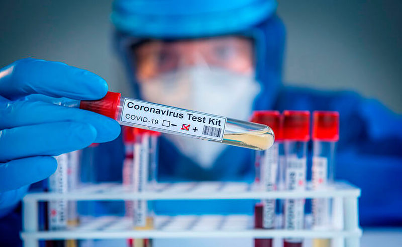 Наборы для анализа на коронавирус загрязнены коронавирусом