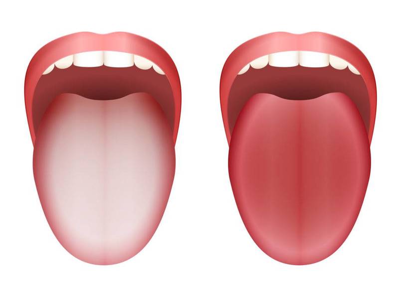 Чистка языка: 5 преимуществ для здоровья