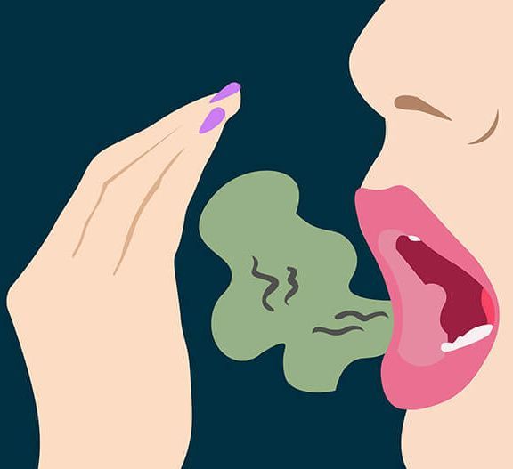 Секрет избавления от хронического неприятного запаха изо рта